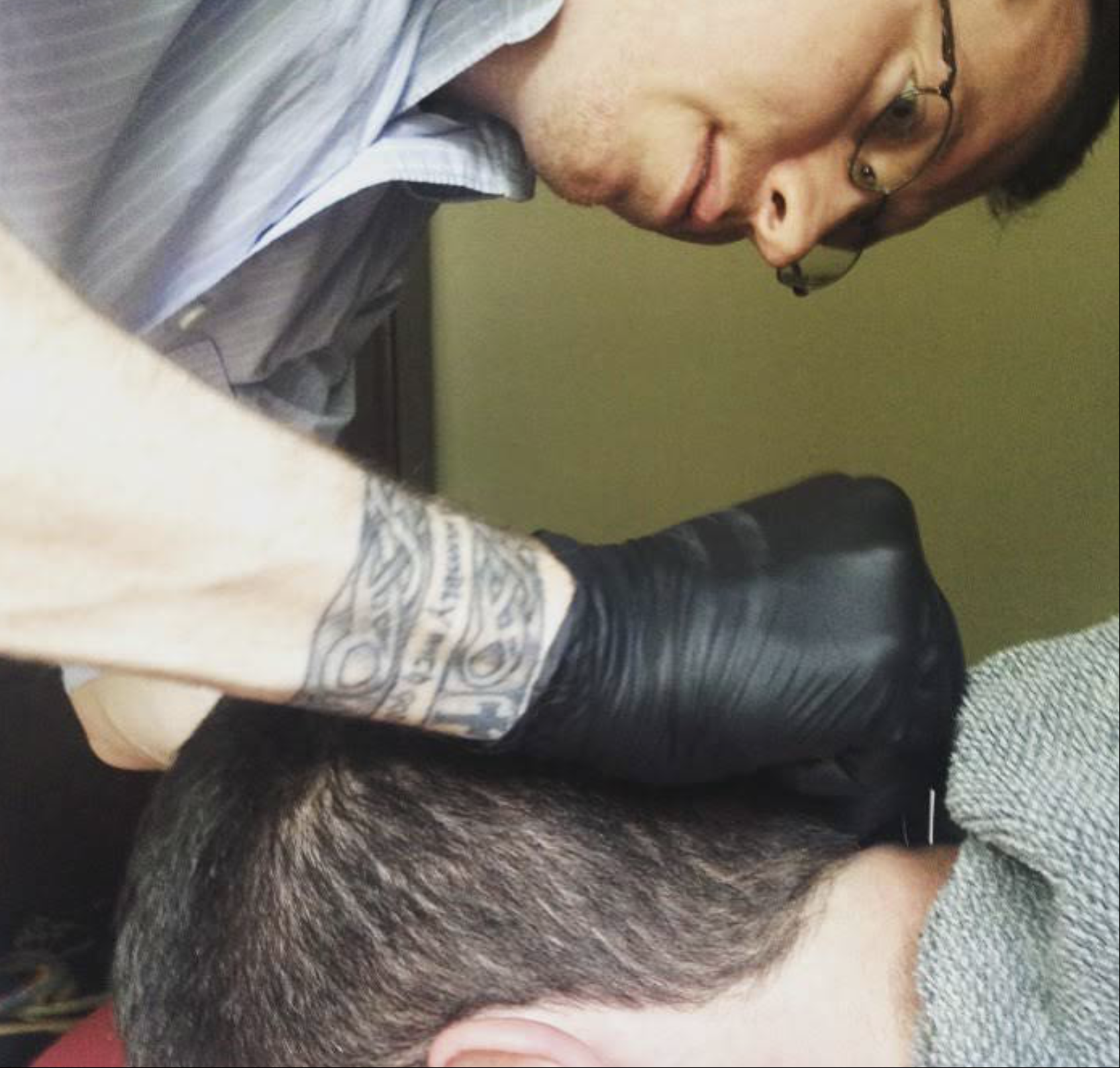 dry needling on neck 901 pt
